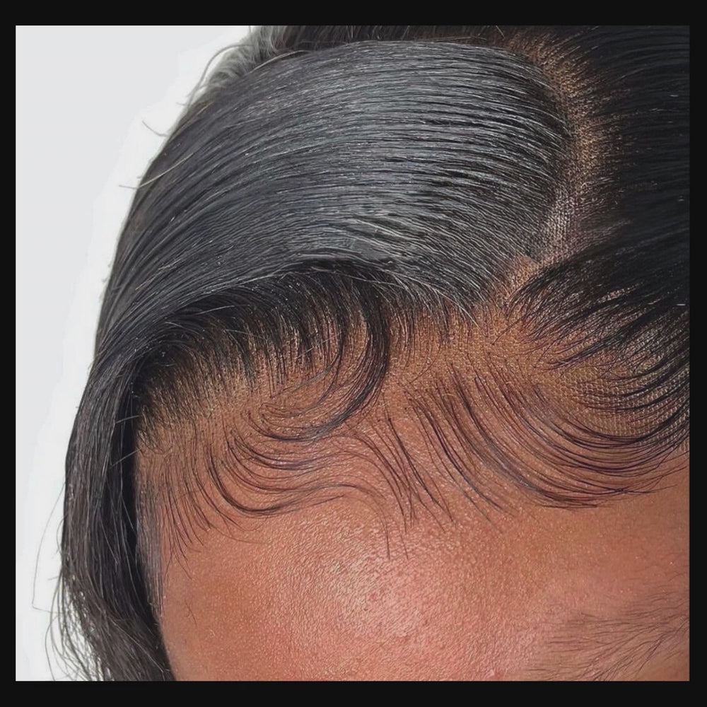 Frontals